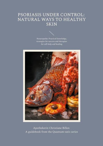 Psoriasis under control: Natural ways to healthy skin