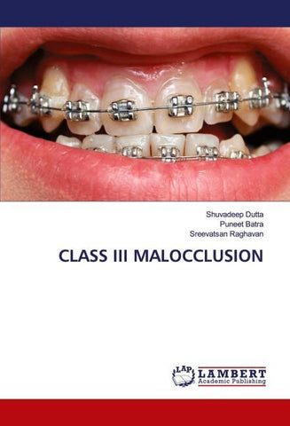 CLASS III MALOCCLUSION
