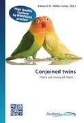 Conjoined twins