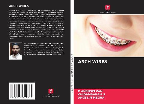 ARCH WIRES