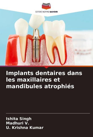 Implants dentaires dans les maxillaires et mandibules atrophiés