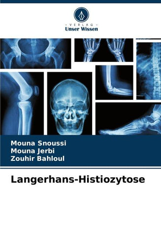 Langerhans-Histiozytose