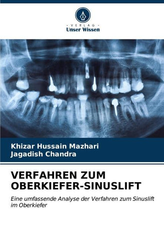 VERFAHREN ZUM OBERKIEFER-SINUSLIFT