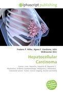 Hepatocellular Carcinoma