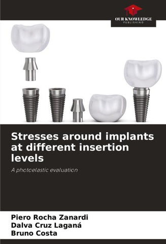 Stresses around implants at different insertion levels