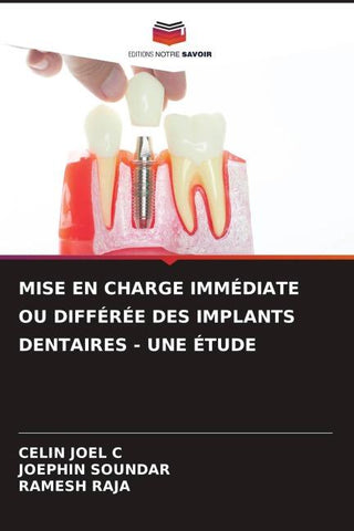 MISE EN CHARGE IMMÉDIATE OU DIFFÉRÉE DES IMPLANTS DENTAIRES - UNE ÉTUDE
