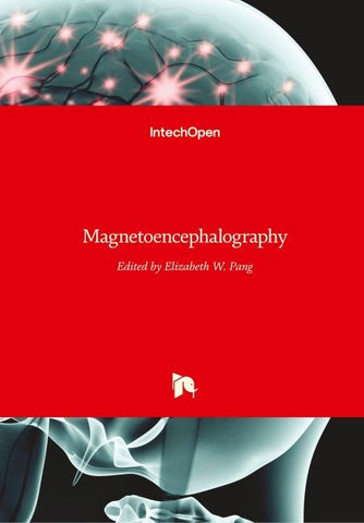 Magnetoencephalography
