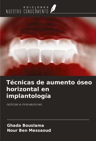 Técnicas de aumento óseo horizontal en implantología