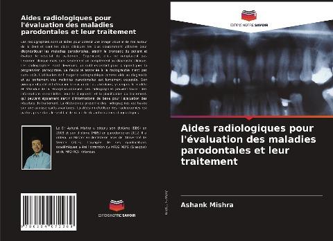 Aides radiologiques pour l'évaluation des maladies parodontales et leur traitement
