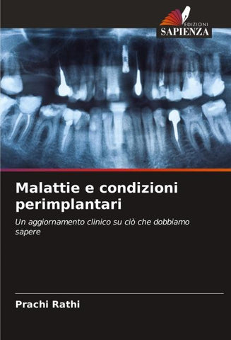 Malattie e condizioni perimplantari