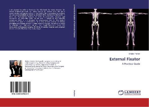 External Fixator