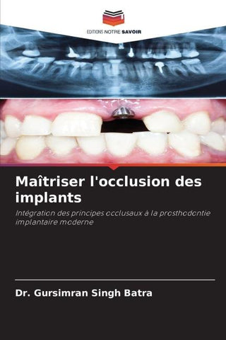 Maîtriser l'occlusion des implants