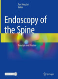 Endoscopy of the Spine