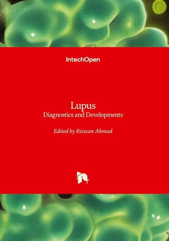 Lupus - Diagnostics and Developments