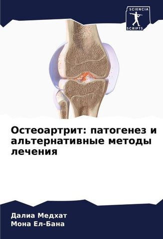 Osteoartrit: patogenez i al'ternatiwnye metody lecheniq