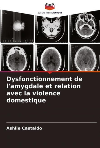 Dysfonctionnement de l'amygdale et relation avec la violence domestique
