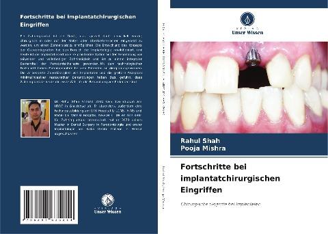 Fortschritte bei implantatchirurgischen Eingriffen