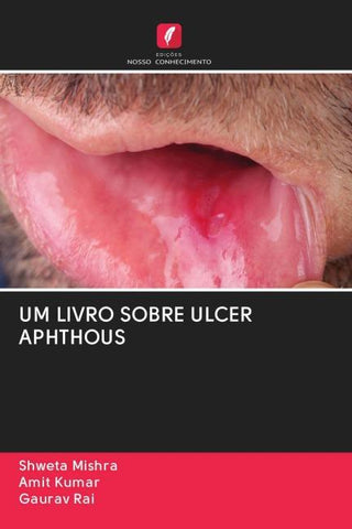 UM LIVRO SOBRE ULCER APHTHOUS