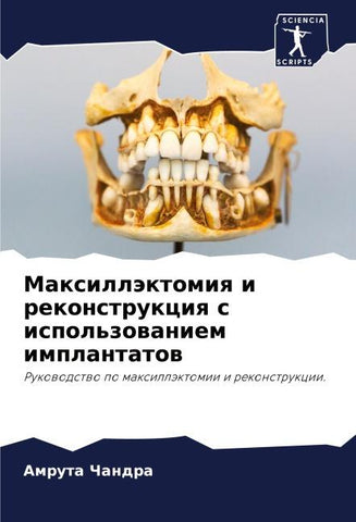 Maxilläktomiq i rekonstrukciq s ispol'zowaniem implantatow