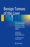 Benign Tumors of the Liver