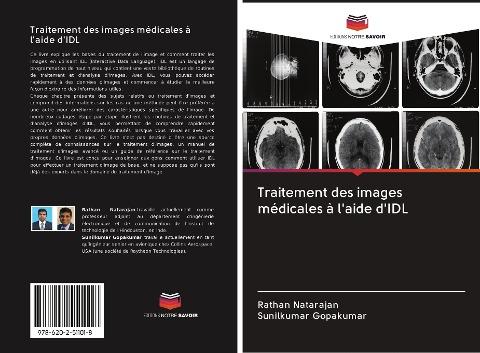 Traitement des images médicales à l'aide d'IDL