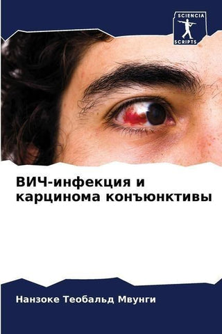 VICh-infekciq i karcinoma kon#ünktiwy
