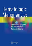 Hematologic Malignancies