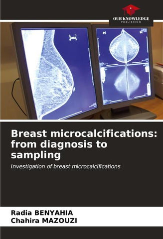 Breast microcalcifications: from diagnosis to sampling