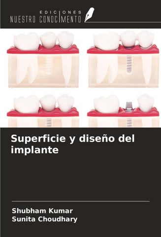 Superficie y diseño del implante