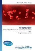 Tuberculose