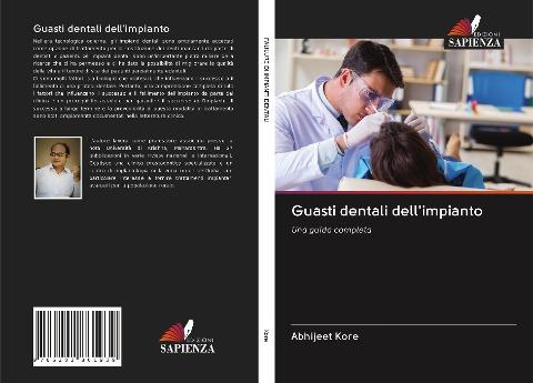 Guasti dentali dell'impianto