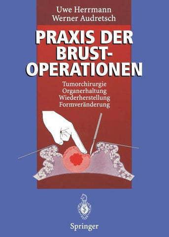 Praxis der Brustoperationen