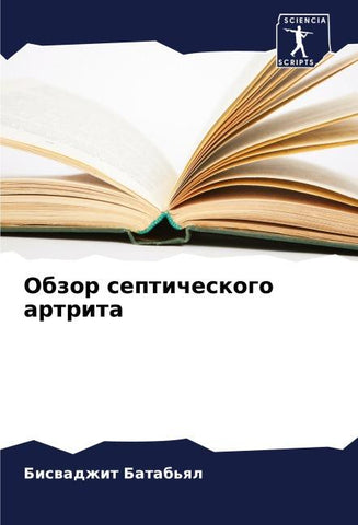Obzor septicheskogo artrita