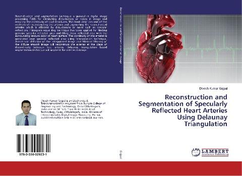 Reconstruction and Segmentation of Specularly Reflected Heart Arteries Using Delaunay Triangulation