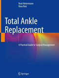 Total Ankle Replacement