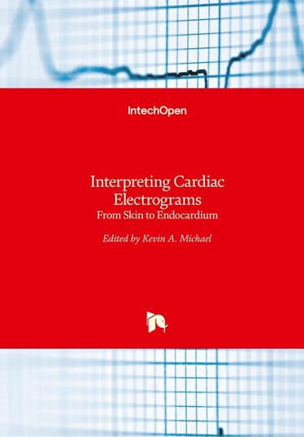 Interpreting Cardiac Electrograms