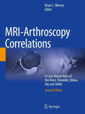 MRI-Arthroscopy Correlations