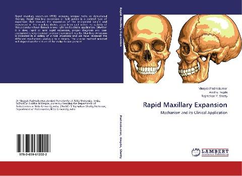Rapid Maxillary Expansion
