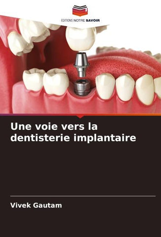 Une voie vers la dentisterie implantaire
