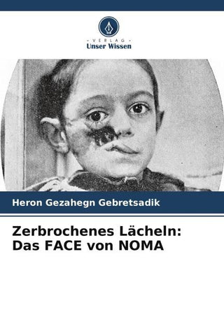Zerbrochenes Lächeln: Das FACE von NOMA
