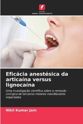 Eficácia anestésica da articaína versus lignocaína