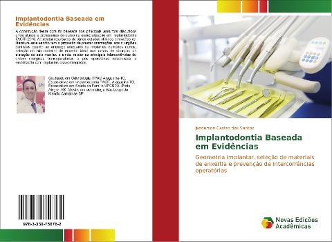 Implantodontia Baseada em Evidências