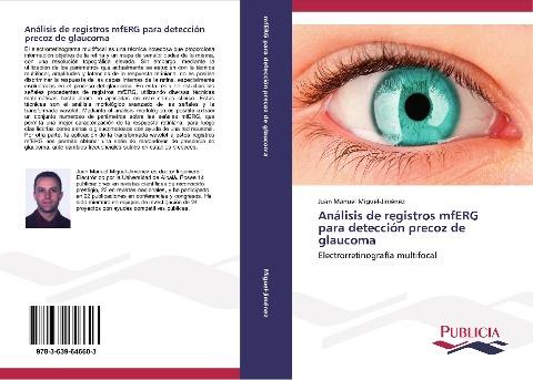 Análisis de registros mfERG para detección precoz de glaucoma