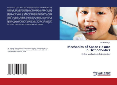 Mechanics of Space closure in Orthodontics