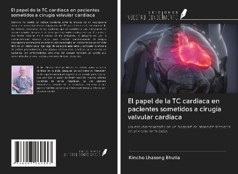El papel de la TC cardiaca en pacientes sometidos a cirugía valvular cardiaca