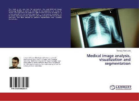 Medical image analysis, visualization and segmentation
