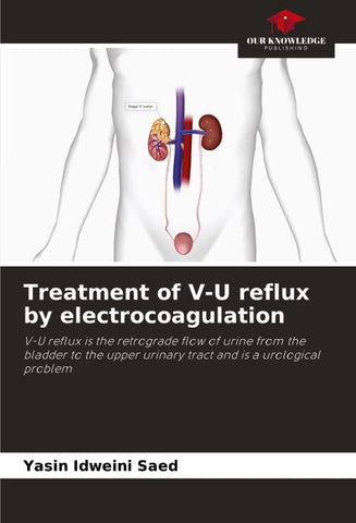 Treatment of V-U reflux by electrocoagulation