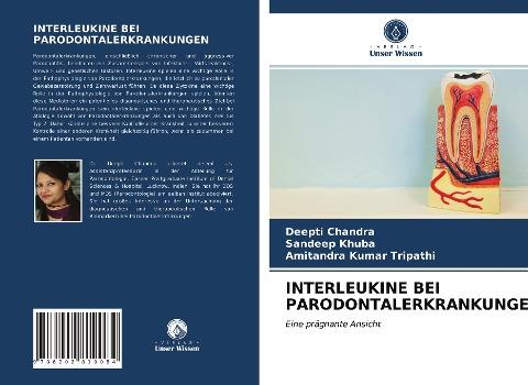 INTERLEUKINE BEI PARODONTALERKRANKUNGEN