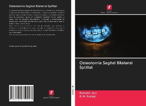 Osteotomia Sagital Bilateral Splittal