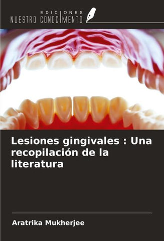 Lesiones gingivales : Una recopilación de la literatura